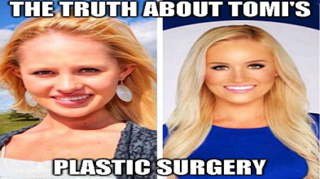 Tomi Lahrens Plastic Surgery - The Truth