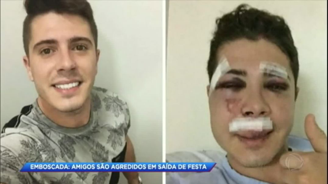 Jovem é brutalmente agredido após encontrar com a ex-namorada em balada