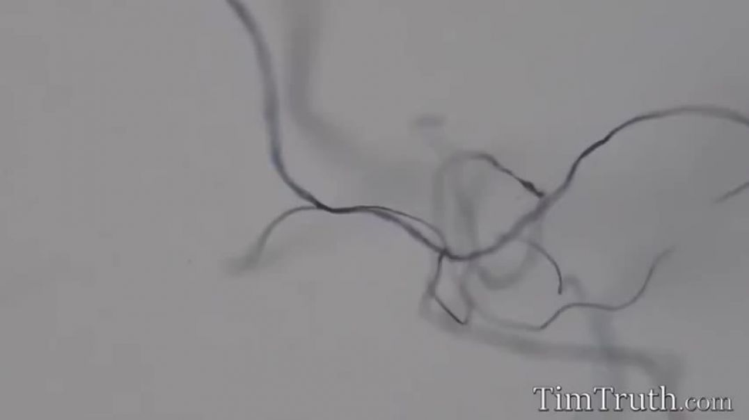 worm-like-mystery-entities-on-masks-amp-swabs-tim-truth-documentary-video