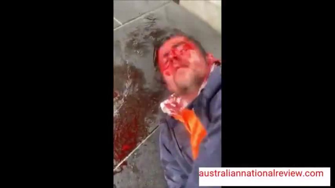 Victorian Man Kyle Mitchell Almost Killed With Rubber Bullets (Graphic)