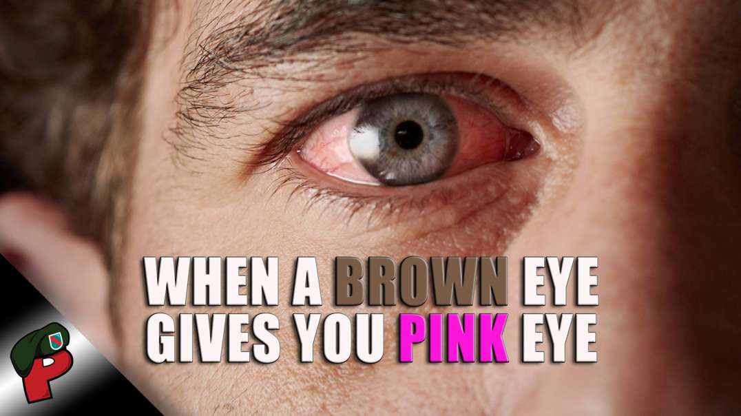 When a Brown Eye Gives You Pink Eye | Grunt Speak Shorts