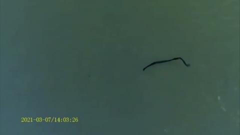 FOUND ON MASKS & SWABS  Moving Black Strands: Parasites? What The Heck Are They?!