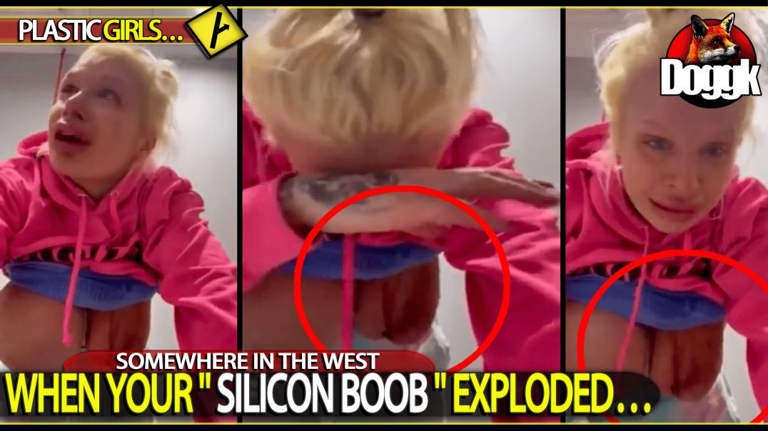 [+18] WHEN YOUR " SILICON BOOB " EXPLODED.. (SOMEWHERE IN THE WEST)