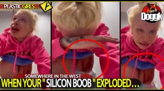 [+18] WHEN YOUR " SILICON BOOB " EXPLODED.. (SOMEWHERE IN THE WEST)