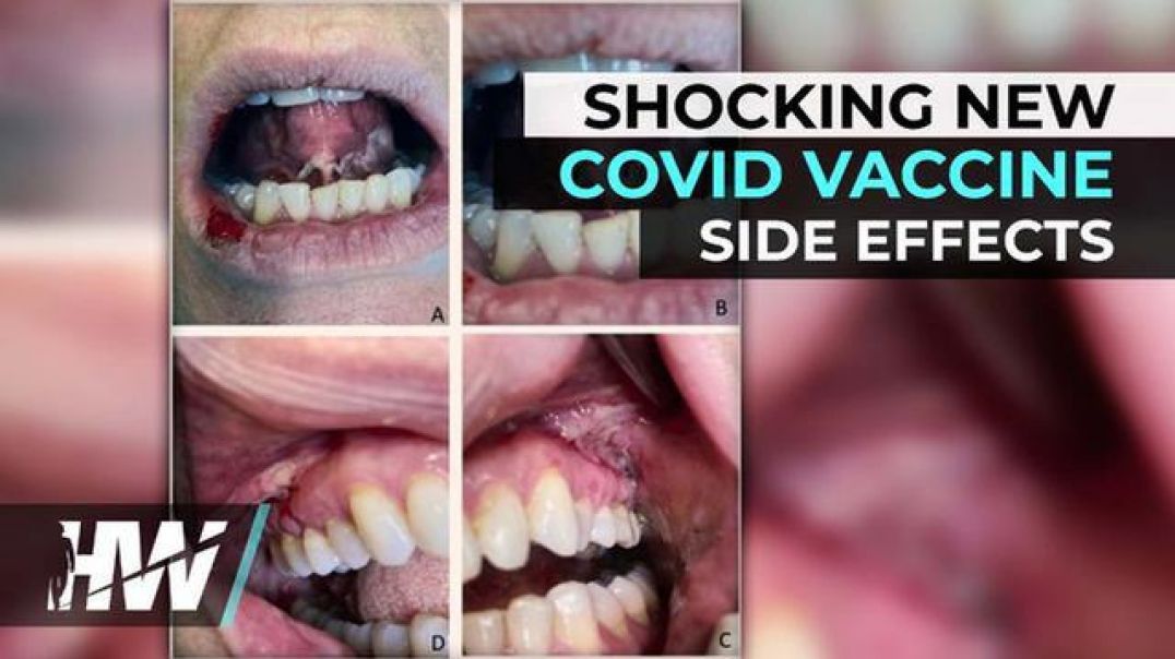 New Covid "Vaccine" Side Effects by The Highwire with Del Bigtree