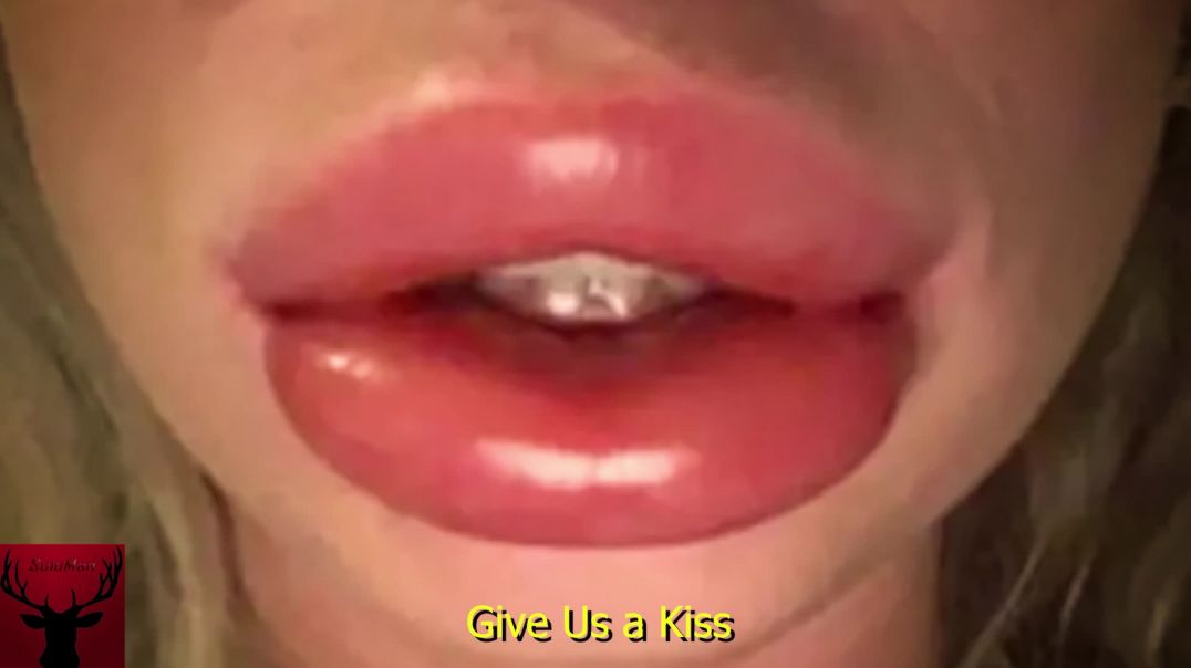 Give Us a Kiss