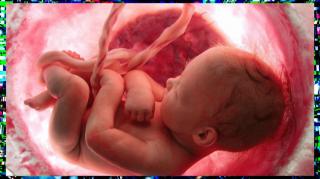 LHLP 121 - 10 Es Legal Matar Bebes En California Literal