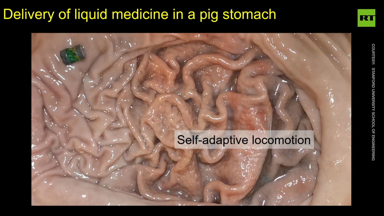 Stanford engineers develop tiny robots to treat patients from the inside