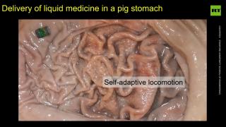 Stanford engineers develop tiny robots to treat patients from the inside