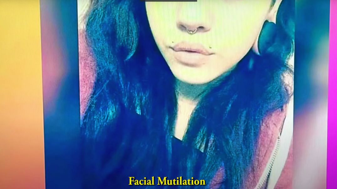 Facial Mutilation