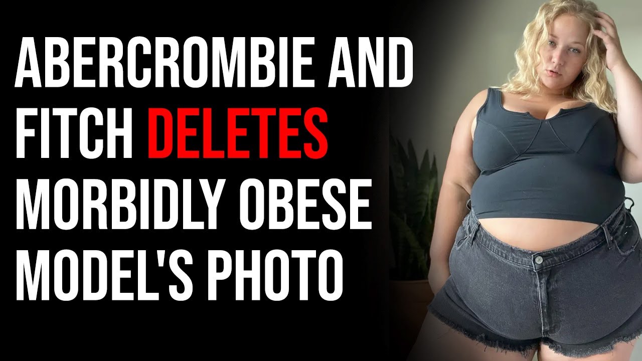 Abercrombie & Fitch DELETES Mobidly Obese Model's Photo