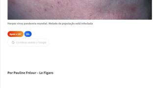 Epidemia Mundial de Herpes - "Porque será ne?"