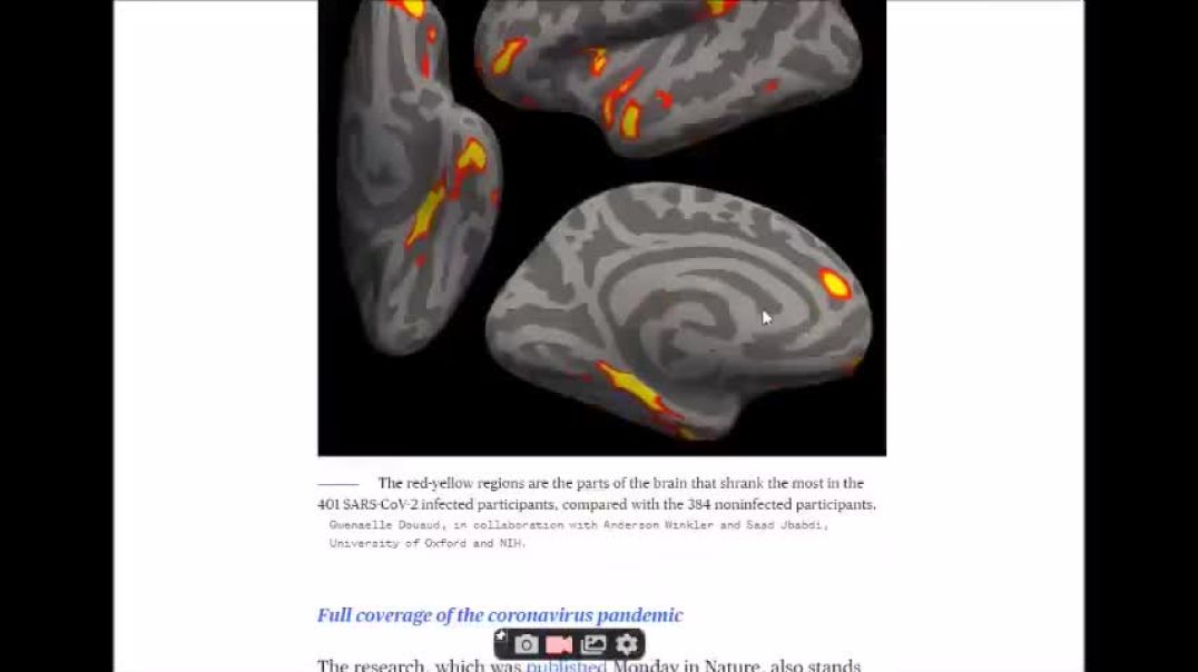 GRAPHENE CAUSES A MASSIVE DROP IN IQ