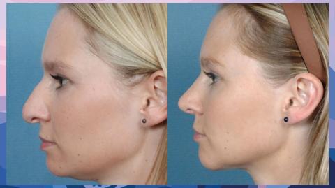 LHLP 126 - 08 Los Profundos Efectos de la Belleza