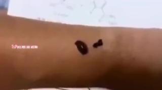 EXPERIMENT FROM JAPAN, LEECHES DIE 3 DAYS AFTER FEEDING ON COVID VACCINATED BLOOD