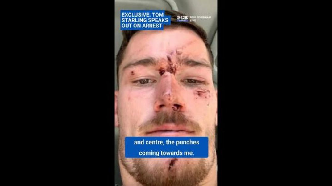 AUSTRALIAN ?? Man BEATEN by POLICE for NO REASON - we want a PROPER INVESTIGATION!!