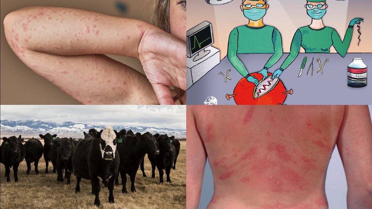 Bombshell! COVID Vaccines Contain Cow Protein That Triggers Deadly