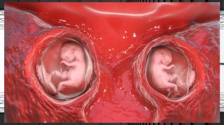 LHLP 132 - 09 Úteros Frescos para Mujeres Trans