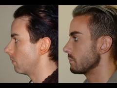 Looks Live: Backtoschoolcel (5'4 tall) Speaks And Are You Getting Cosmetic Surgery?