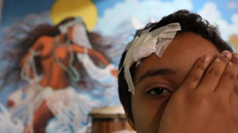 ADENDO - Criança Apedrejada no Rio é Vítima de Intolerância Religiosa!