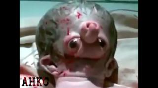 Bizarre babies