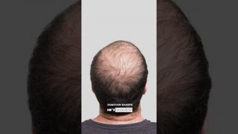 Hypergamy: THE TWO TYPES