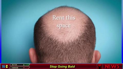 Stop Going Bald