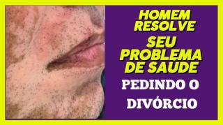HOMEM, APÓS ANOS DE CASADO, DESCOBRE QUE SEU PROBLEMA DE SAÚDE ERA SEU CASAMENTO TÓXICO!