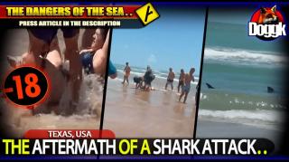 [+16] THE AFTERMATH OF A SHARK ATTACK.. (USA) >> PRESS ARTICLE IN THE DESCRIPTION..