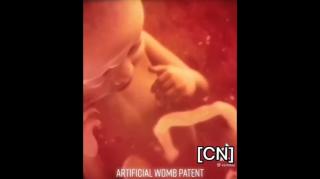 Artificial womb