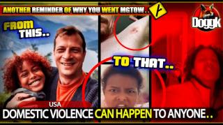 DOMESTIC VIOLENCE CAN HAPPEN TO ANYONE.. (USA) >> NEVER LET ANYONE TREAT YOU LIKE THIS !!!