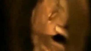 PROOF THAT ABORTION IS MURDER: SEE WHAT BABIES DO INSIDE THEIR MOTHER'S WOMB