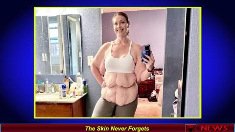 The Skin Never Forgets