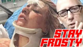 Black Man Breaks Bachelorette's Nose and Knocks Out 3 Teeth