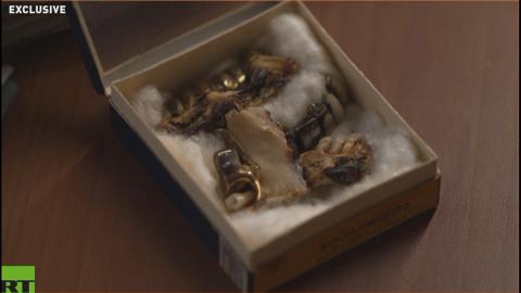 Hitler's teeth confirm he died in Berlin — Russian archives reveal