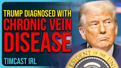 Trump DIAGNOSED With CHRONIC VEIN DISEASE, Covers Hand With Makeup