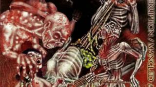 Artery Eruption - Ultimately Uterectomized