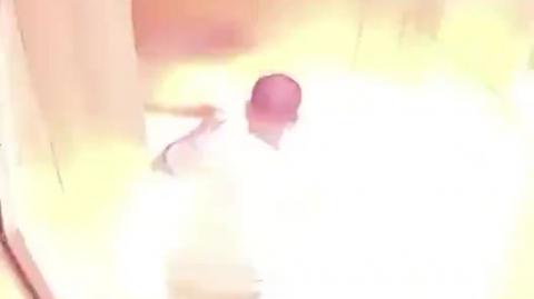 Exploding eBike battery burns owner to a crisp in the elevator - SAD VIDEO