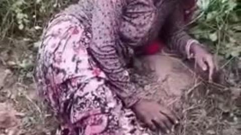 Robbers Chop-off Elderly woman's feet for silver anklets