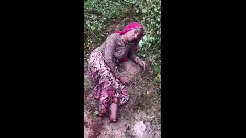 Robbers Chop-off Elderly woman's feet for silver anklets