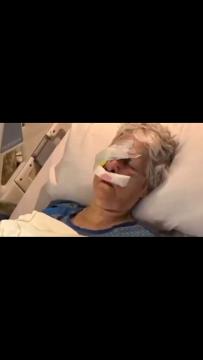 Violent Repeat Offender Smacks 75 Year Old in Head Blinding Her