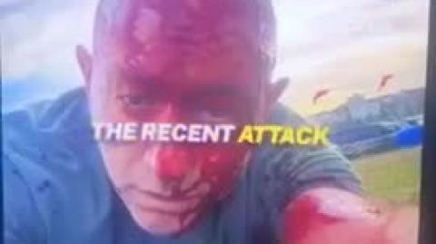 Proof the Bondi Beach event was a Jewish false flag with Jewish crisis actors and fake blood