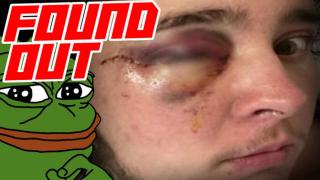 ICE Rioter Claims He's Blind in One Eye After Federal Officer Shot Him