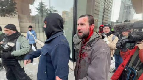 TIMES UP IN MINNEAPOLIS, ICE KARENS RUINING THEIR LIVES & MORE