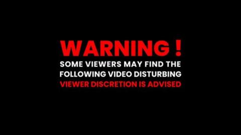 Woman gets her brain ICEd