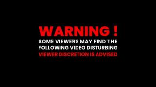 Woman gets her brain ICEd