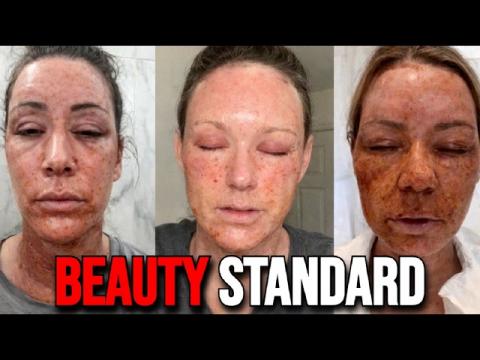 Western Women Are RUINING Their Faces With Laser Treatments