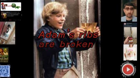 Adam's ribs are broken