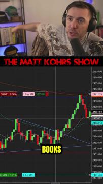 This Is Why Most Traders Never Win