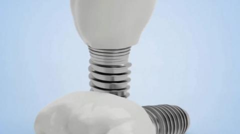 Do Dental Implants Trigger Alarms through Airport Security? | Triveni Dental | Dr. Kapil Sharma